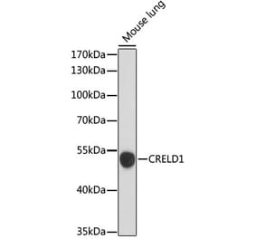 Western Blot - Anti-CRELD1 Antibody (A90365) - Antibodies.com