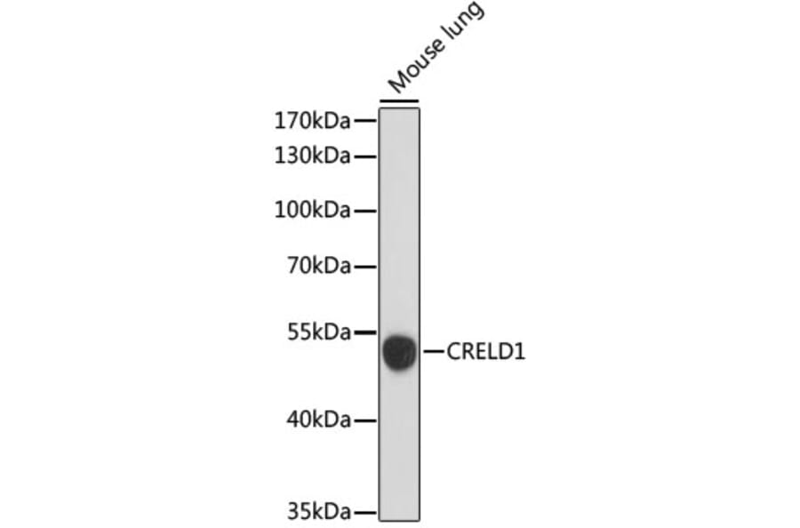 Western Blot - Anti-CRELD1 Antibody (A90365) - Antibodies.com