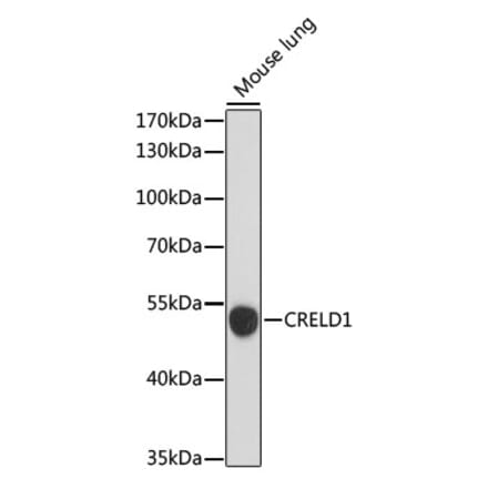 Western Blot - Anti-CRELD1 Antibody (A90365) - Antibodies.com