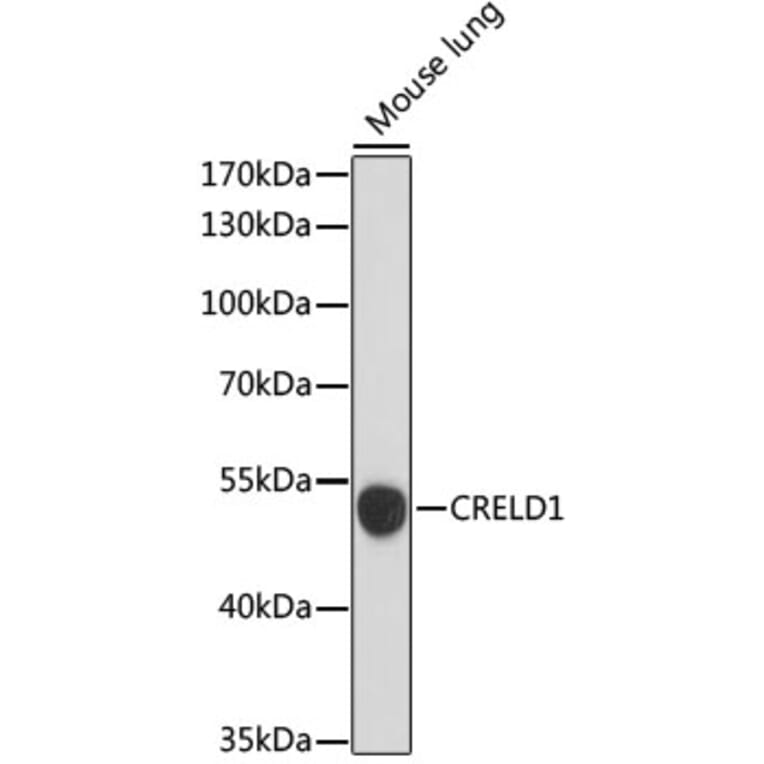 Western Blot - Anti-CRELD1 Antibody (A90365) - Antibodies.com