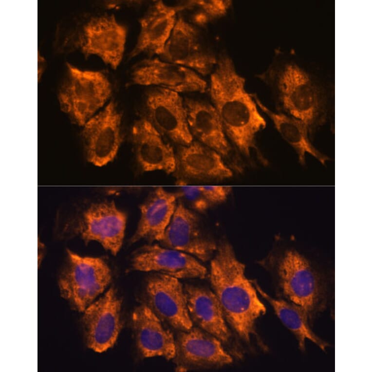 Immunofluorescence - Anti-CRELD1 Antibody (A90365) - Antibodies.com