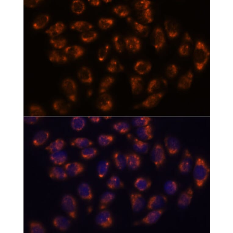 Immunofluorescence - Anti-CRELD1 Antibody (A90365) - Antibodies.com