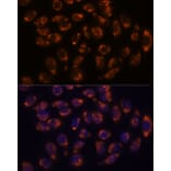 Immunofluorescence - Anti-CRELD1 Antibody (A90365) - Antibodies.com