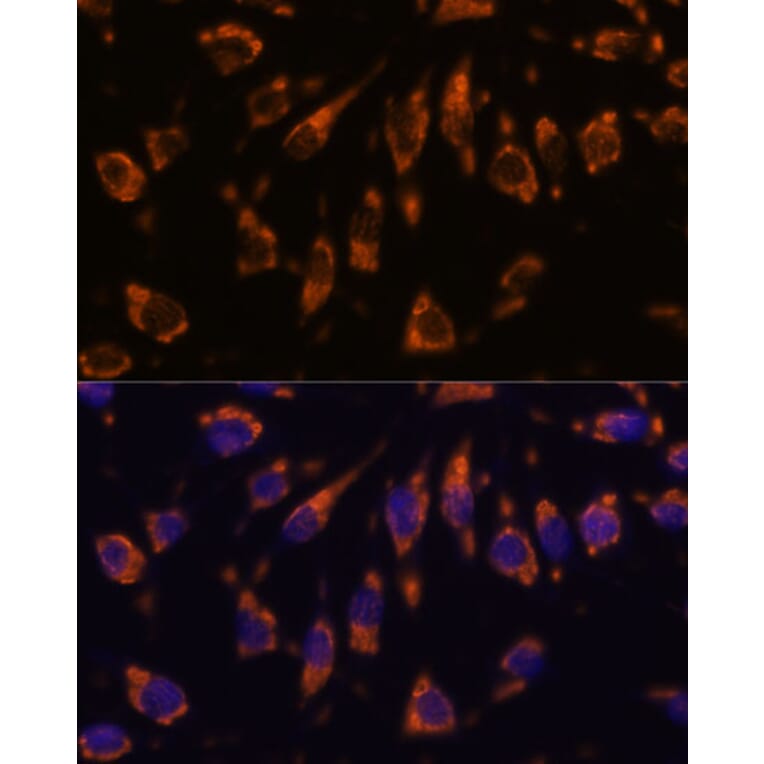 Immunofluorescence - Anti-CRELD1 Antibody (A90365) - Antibodies.com