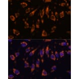 Immunofluorescence - Anti-CRELD1 Antibody (A90365) - Antibodies.com