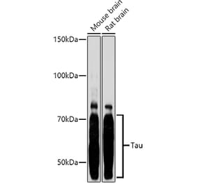Western Blot - Anti-Tau Antibody (A90366) - Antibodies.com