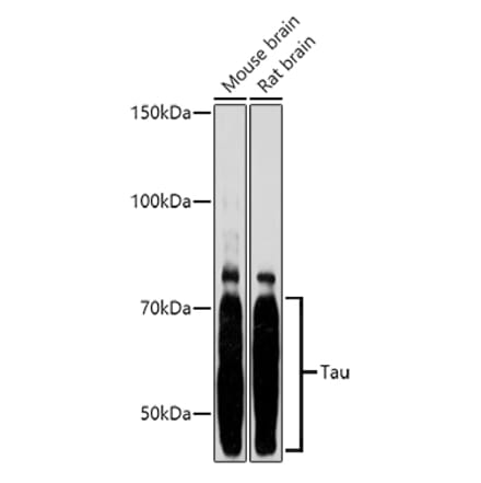 Western Blot - Anti-Tau Antibody (A90366) - Antibodies.com