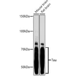 Western Blot - Anti-Tau Antibody (A90366) - Antibodies.com