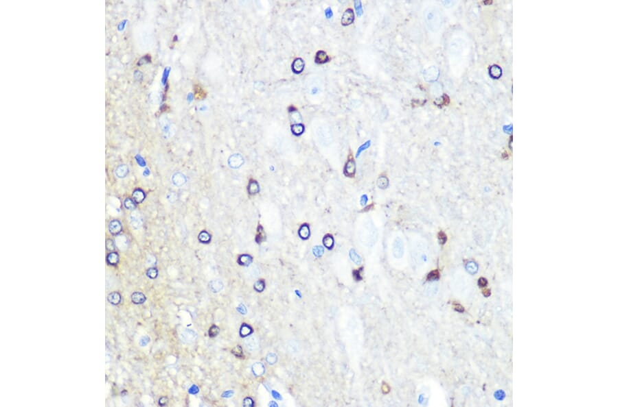Immunohistochemistry - Anti-Tau Antibody (A90366) - Antibodies.com