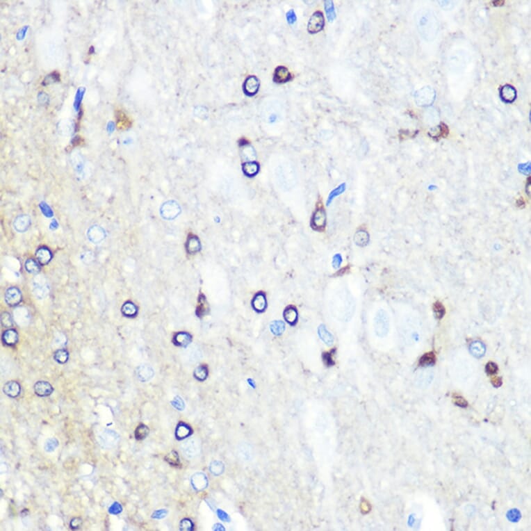 Immunohistochemistry - Anti-Tau Antibody (A90366) - Antibodies.com