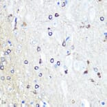 Immunohistochemistry - Anti-Tau Antibody (A90366) - Antibodies.com