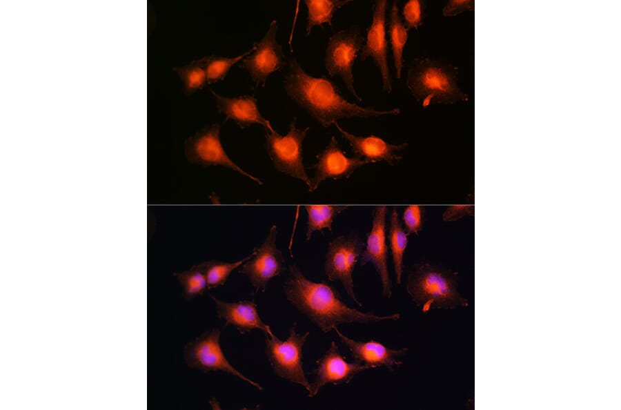 Immunofluorescence - Anti-Tau Antibody (A90366) - Antibodies.com