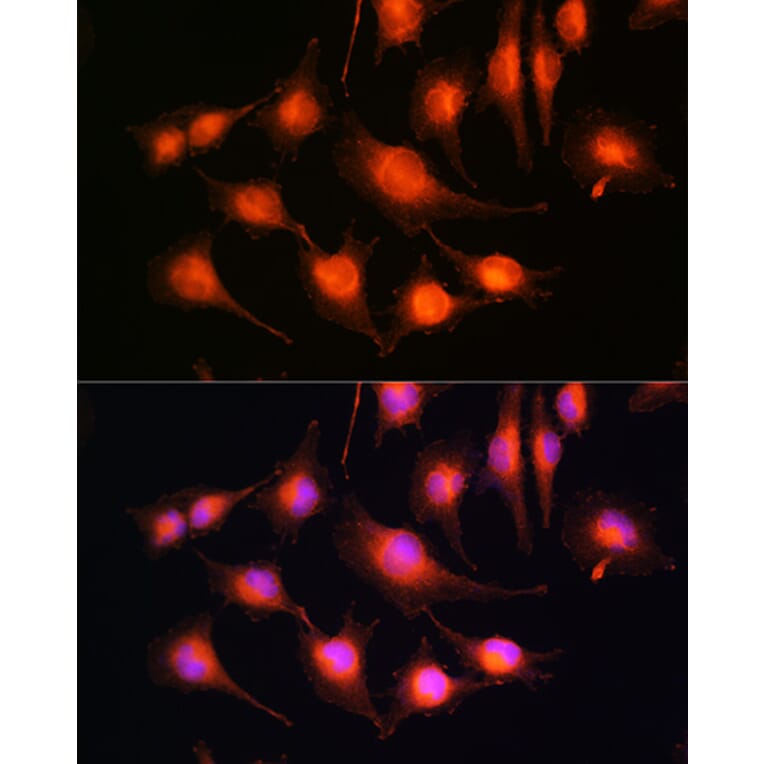 Immunofluorescence - Anti-Tau Antibody (A90366) - Antibodies.com