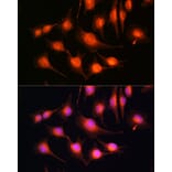 Immunofluorescence - Anti-Tau Antibody (A90366) - Antibodies.com