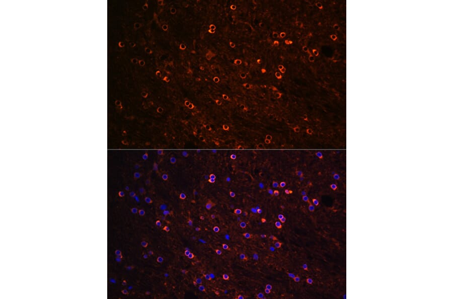 Immunofluorescence - Anti-Tau Antibody (A90366) - Antibodies.com