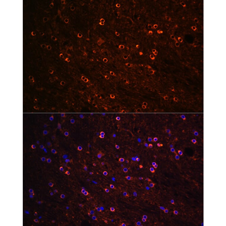 Immunofluorescence - Anti-Tau Antibody (A90366) - Antibodies.com