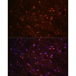 Immunofluorescence - Anti-Tau Antibody (A90366) - Antibodies.com