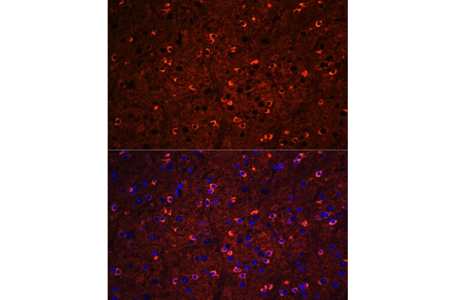 Immunofluorescence - Anti-Tau Antibody (A90366) - Antibodies.com