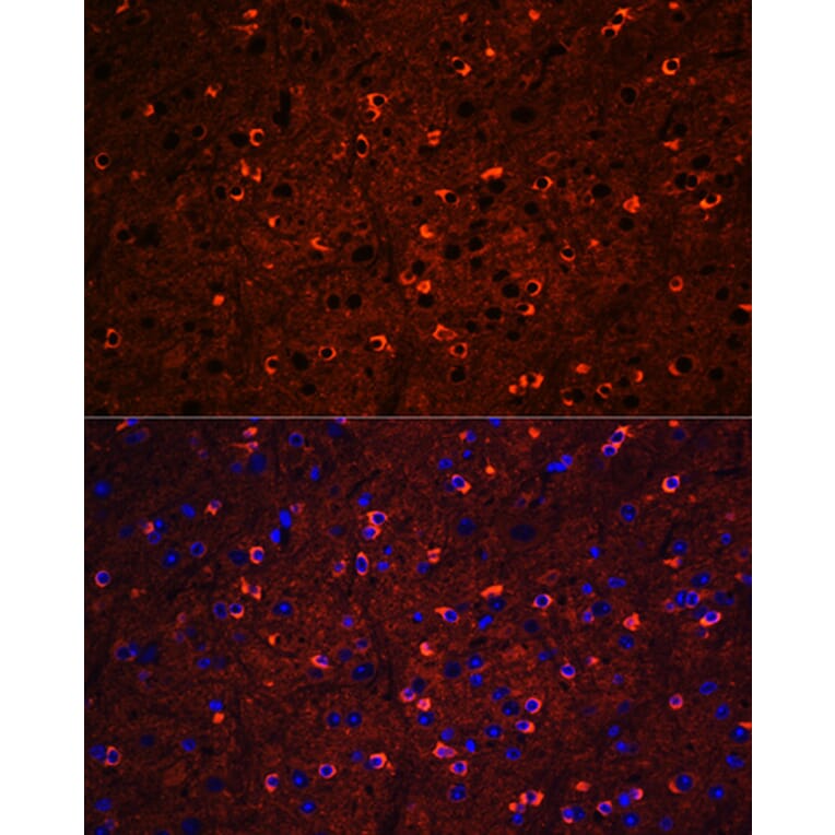 Immunofluorescence - Anti-Tau Antibody (A90366) - Antibodies.com