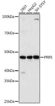 Western blot analysis of extracts of various cell lines, using Anti-PRR5 Antibody (A15170) at 1:1,000 dilution.
Secondary antibody: Goat Anti-Rabbit IgG (H+L) (HRP) (AS014) at 1:10,000 dilution.
Lysates / proteins: 25µg per lane.
Blocking buffer: 3% non-fat dry milk in TBST.
Detection: ECL Basic Kit (RM00020).
Exposure time: 10s.