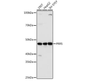 Western Blot - Anti-Protor-1 Antibody (A90367) - Antibodies.com