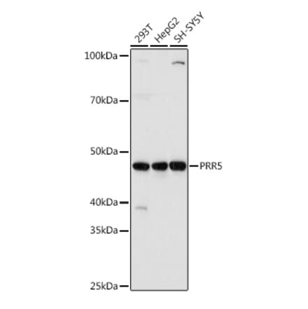 Western Blot - Anti-Protor-1 Antibody (A90367) - Antibodies.com