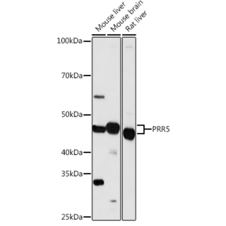 Western Blot - Anti-Protor-1 Antibody (A90367) - Antibodies.com