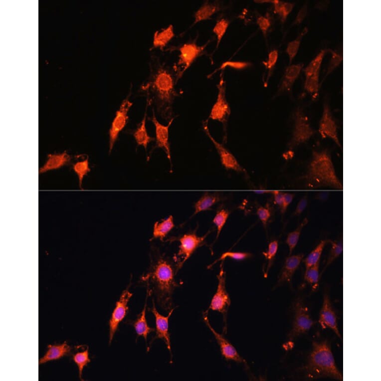 Immunofluorescence - Anti-Protor-1 Antibody (A90367) - Antibodies.com