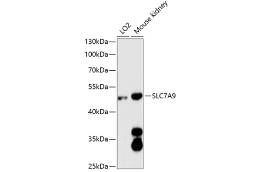 Western Blot - Anti-SLC7A9 Antibody (A90368) - Antibodies.com