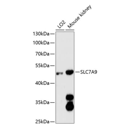 Western Blot - Anti-SLC7A9 Antibody (A90368) - Antibodies.com