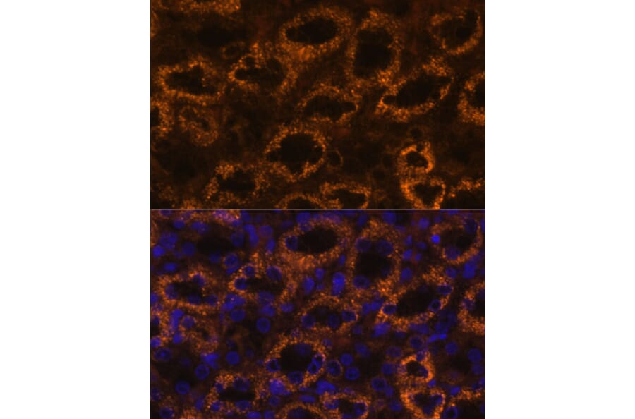 Immunofluorescence - Anti-SLC7A9 Antibody (A90368) - Antibodies.com