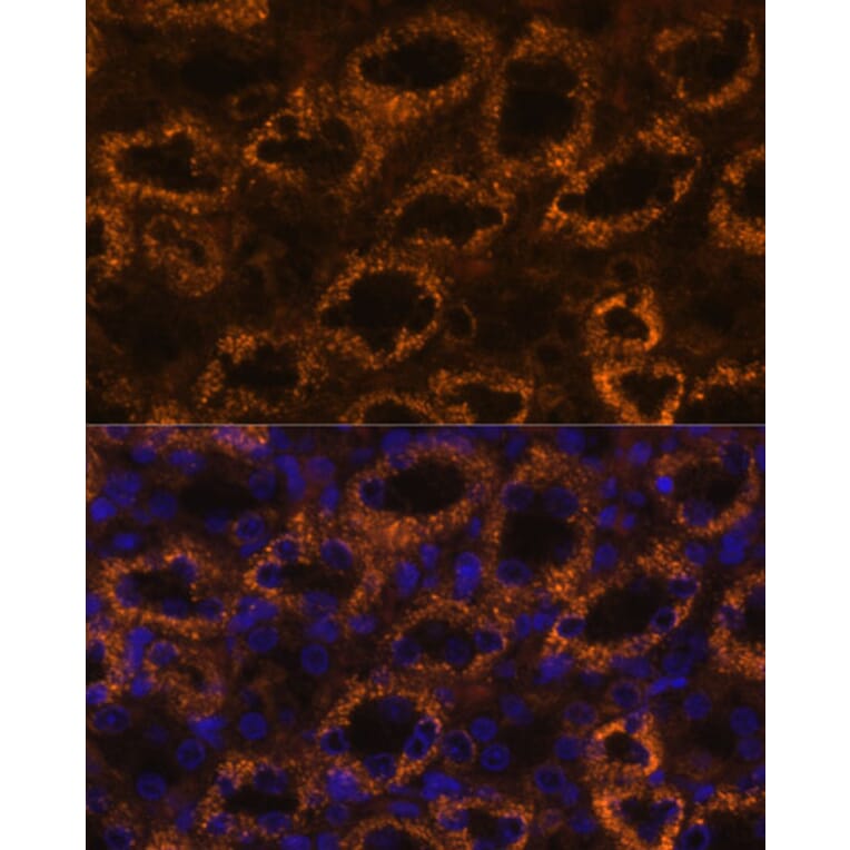 Immunofluorescence - Anti-SLC7A9 Antibody (A90368) - Antibodies.com