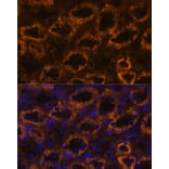 Immunofluorescence - Anti-SLC7A9 Antibody (A90368) - Antibodies.com