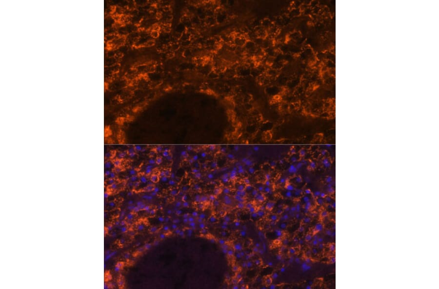 Immunofluorescence - Anti-SLC7A9 Antibody (A90368) - Antibodies.com