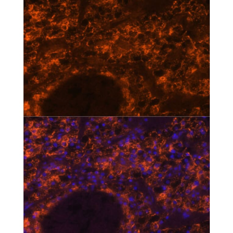 Immunofluorescence - Anti-SLC7A9 Antibody (A90368) - Antibodies.com