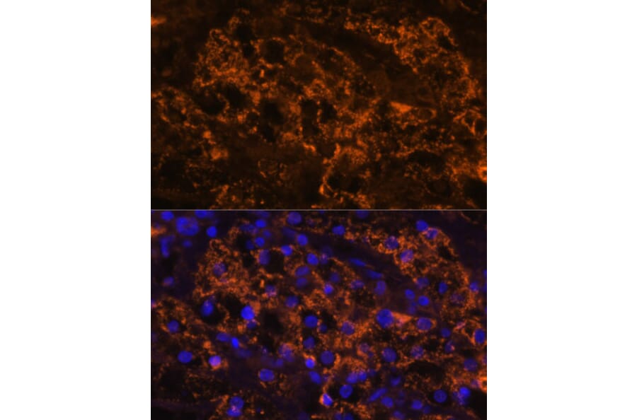 Immunofluorescence - Anti-SLC7A9 Antibody (A90368) - Antibodies.com