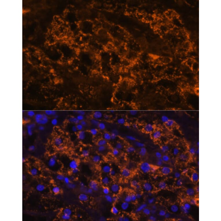 Immunofluorescence - Anti-SLC7A9 Antibody (A90368) - Antibodies.com