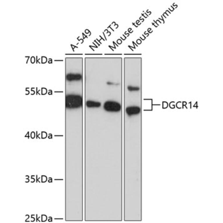 Western Blot - Anti-ESS2 Antibody (A90369) - Antibodies.com