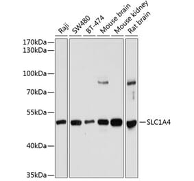 Western Blot - Anti-ASCT-1 Antibody (A90370) - Antibodies.com