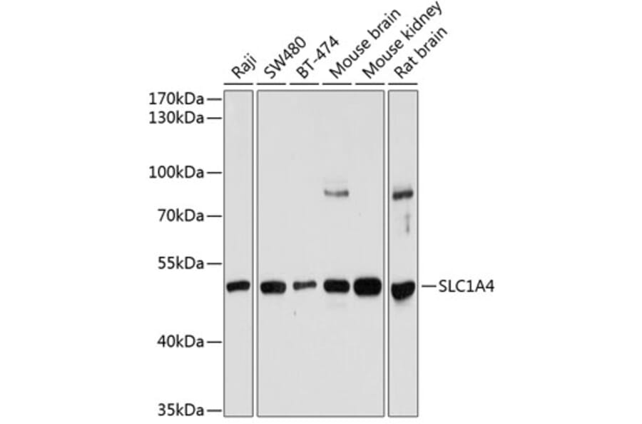 Western Blot - Anti-ASCT-1 Antibody (A90370) - Antibodies.com