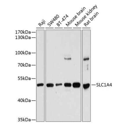 Western Blot - Anti-ASCT-1 Antibody (A90370) - Antibodies.com