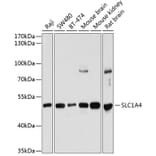 Western Blot - Anti-ASCT-1 Antibody (A90370) - Antibodies.com