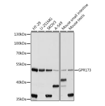 Western Blot - Anti-SREB3 Antibody (A90371) - Antibodies.com