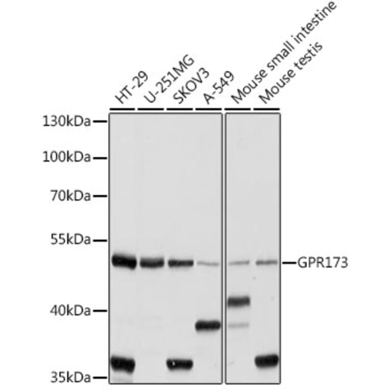 Western Blot - Anti-SREB3 Antibody (A90371) - Antibodies.com