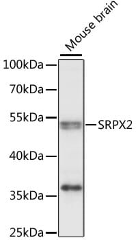 Western blot analysis of extracts of mouse brain, using Anti-SRPX2 Antibody (A15434) at 1:1,000 dilution.
Secondary antibody: Goat Anti-Rabbit IgG (H+L) (HRP) (AS014) at 1:10,000 dilution.
Lysates / proteins: 25µg per lane.
Blocking buffer: 3% non-fat dry milk in TBST.
Detection: ECL Enhanced Kit (RM00021).
Exposure time: 10s.