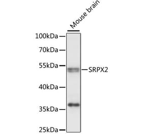 Western Blot - Anti-SRPX2 Antibody (A90373) - Antibodies.com