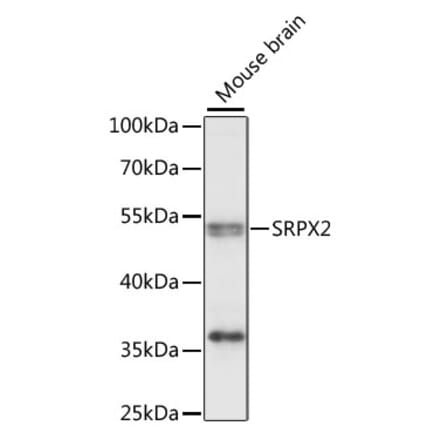 Western Blot - Anti-SRPX2 Antibody (A90373) - Antibodies.com