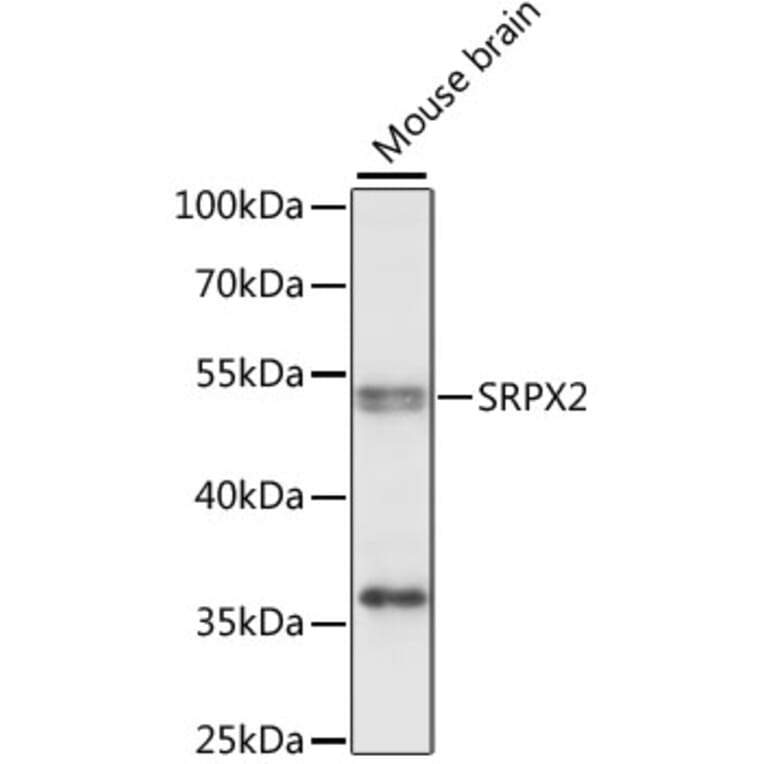Western Blot - Anti-SRPX2 Antibody (A90373) - Antibodies.com