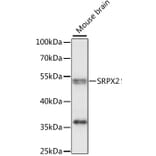 Western Blot - Anti-SRPX2 Antibody (A90373) - Antibodies.com