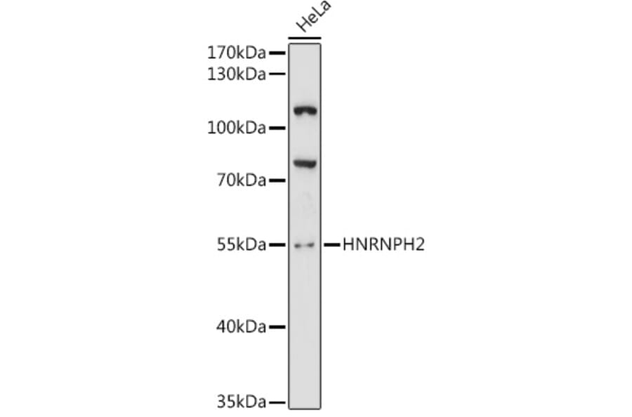 Western Blot - Anti-HNRPH2/HNRNPH2 Antibody (A90374) - Antibodies.com